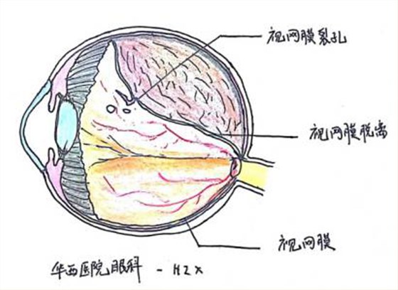 圖片1